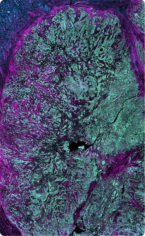 Multiplex IF tissue scan
