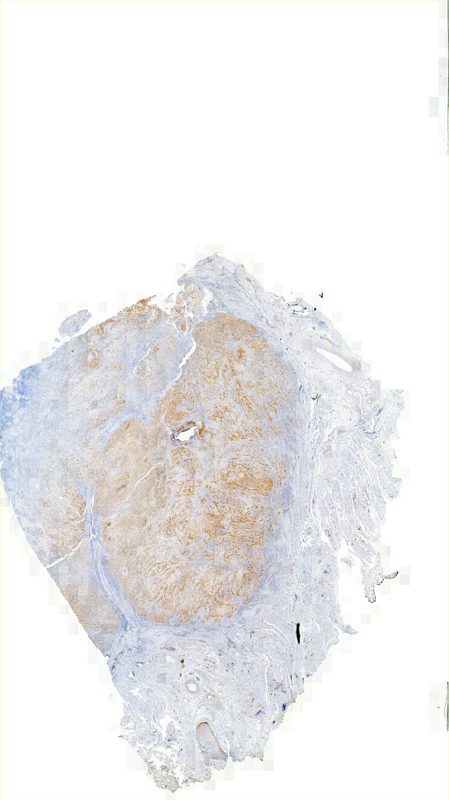 IHC staining