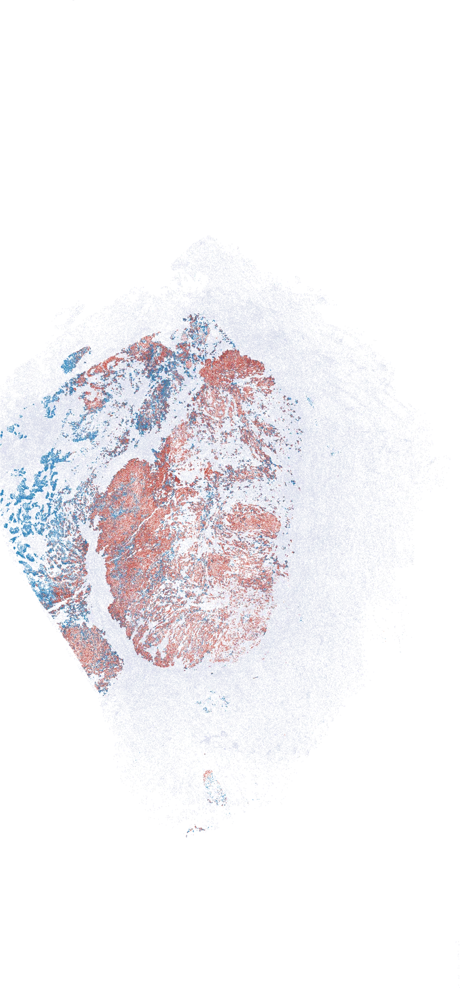 ITGa6 positivity spatial analysis