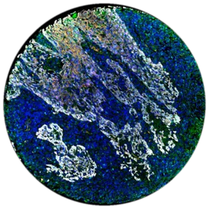 Tumour core in multiplex immunofluorescence, blue nuclei with white epithelial islands